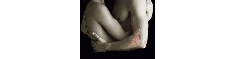 France psoriasis lance sa première campagne