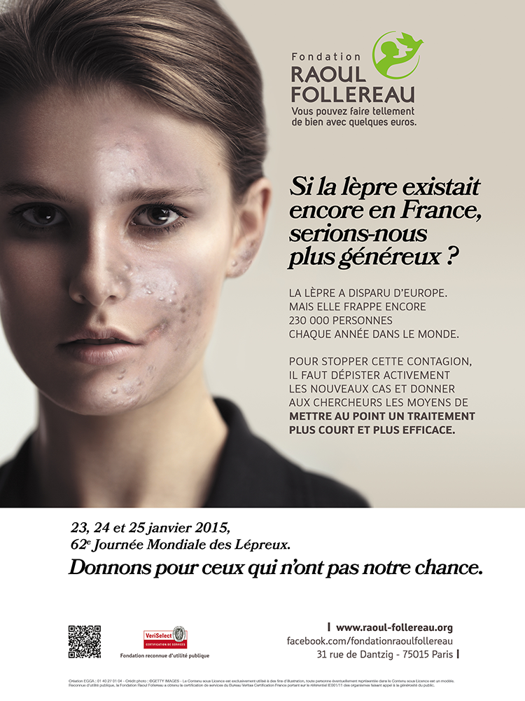 La lèpre existe toujours, les associations se mobilisent