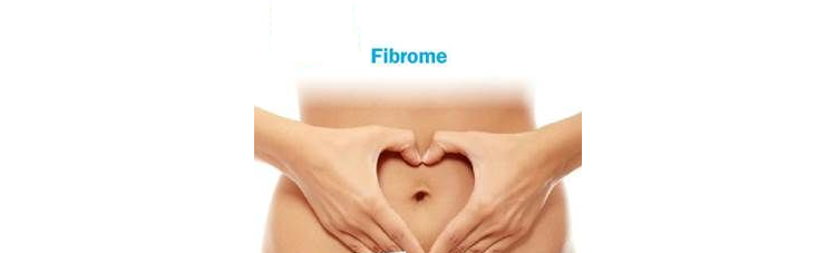 Fibrome utérin: halte à la banalisation!
