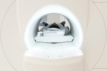 Dépistage du cancer du poumon : un enjeu majeur de santé publique